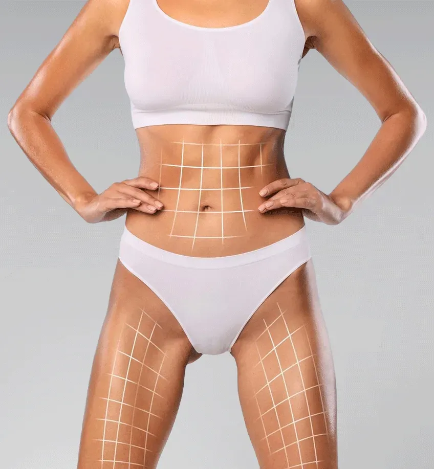 Mommy makeover in Colombia